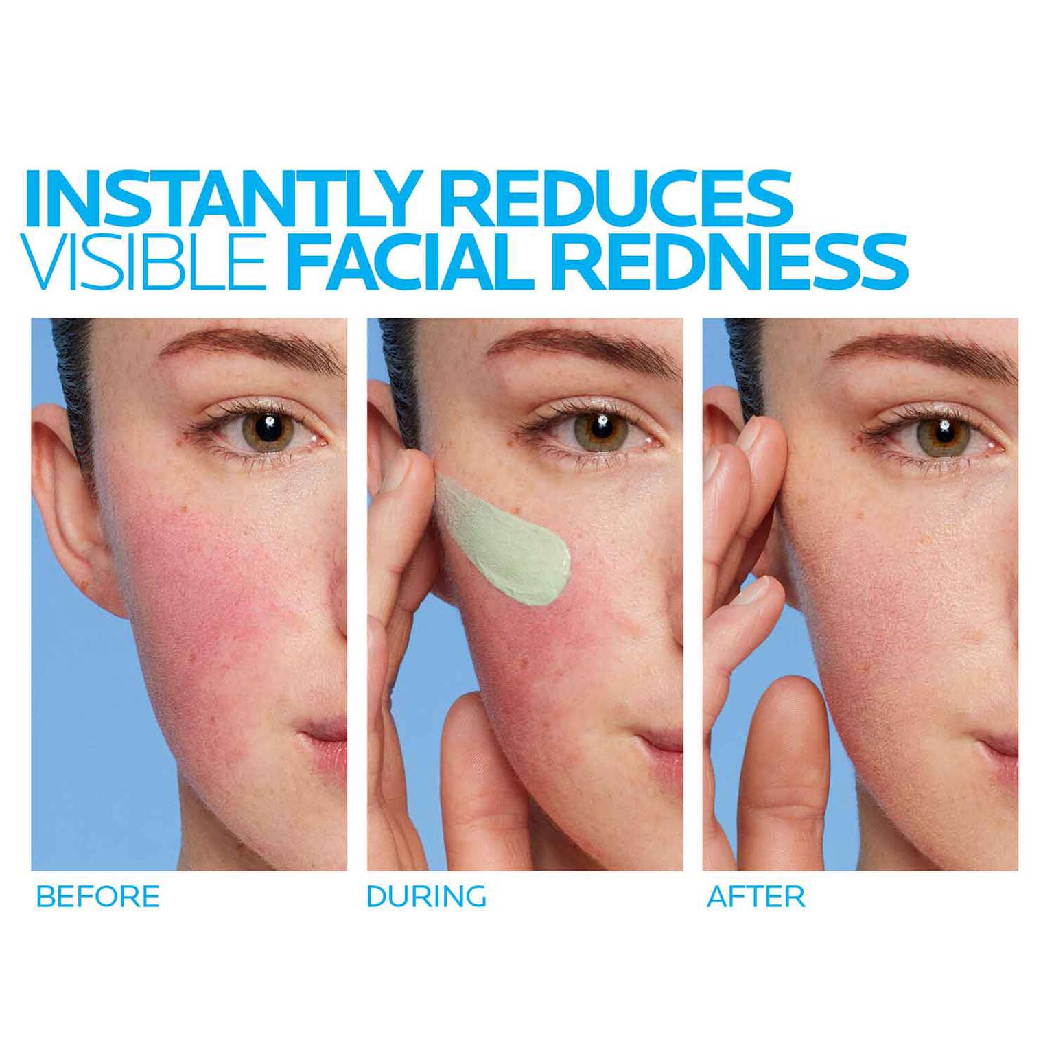 toleriane-rosaliac-ar-face-cream-for-visible-redness-h2 8_Toleriane_Rosaliac-AR-before-after.jpg