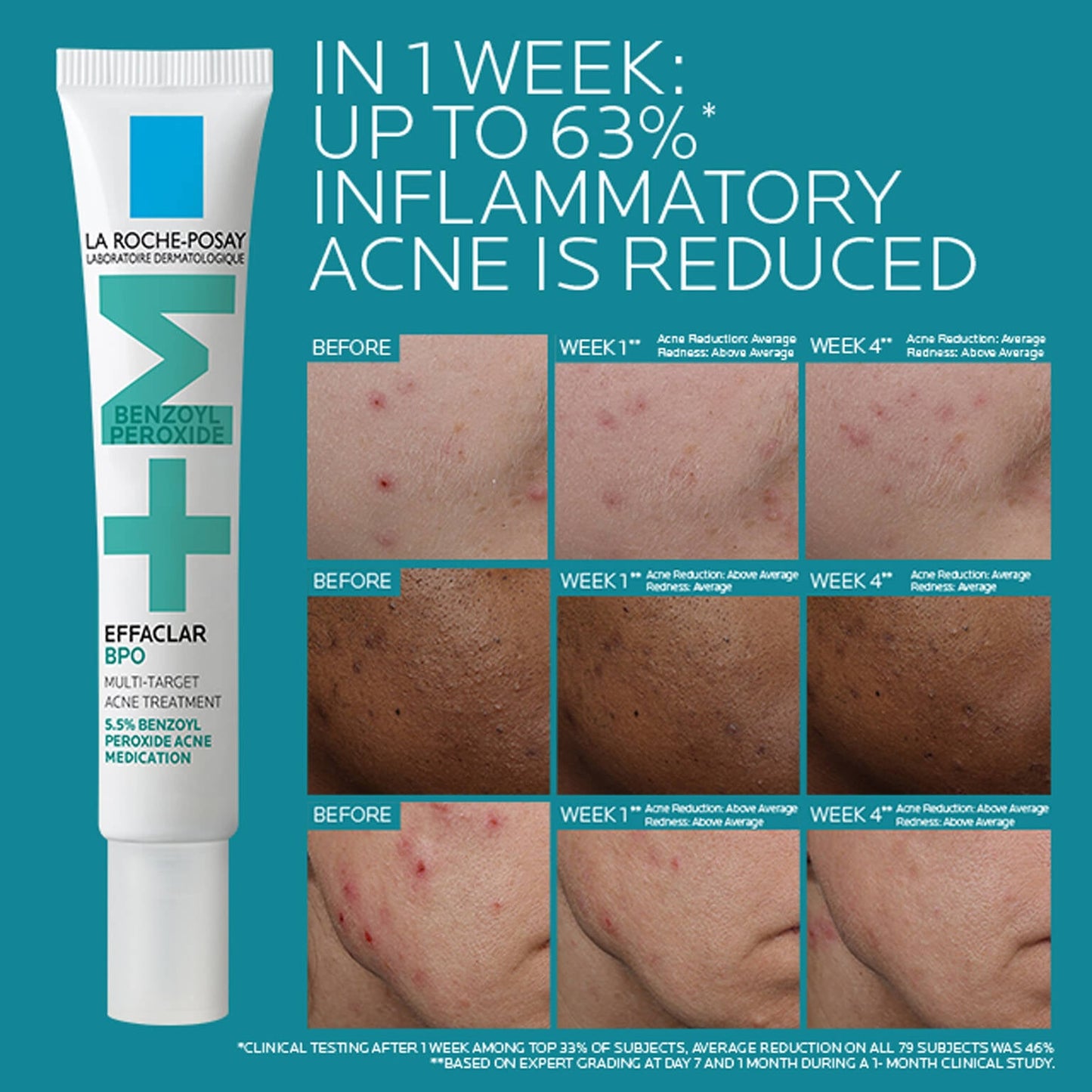 effaclar-bpo-multi-target-acne-treatment-with-5-5-benzoyl-peroxide-y9 EffaclarBPO-ClinicalBA-ATF-1500x1500-2.jpg