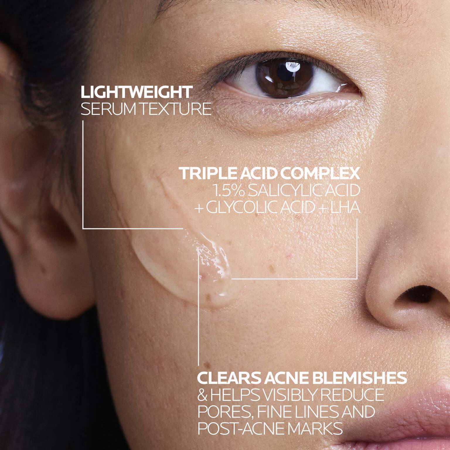 effaclar-salicylic-acid-acne-treatment-serum-d0 LaRochePosay-Product-Effaclar-Effaclar-Serum-30ml-3337875722827-Texture-REV.jpg
