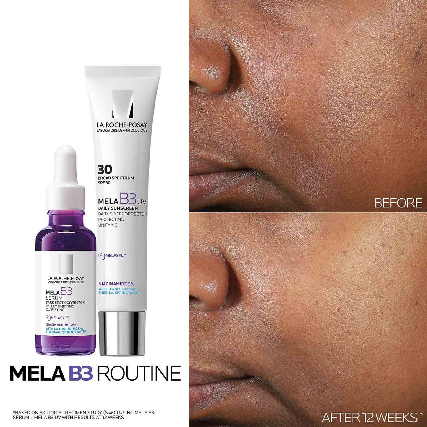 mela-b3-dark-spot-serum-with-melasyltm-niacinamide-m7 Mela-B3-routine_1500X1500.jpg
