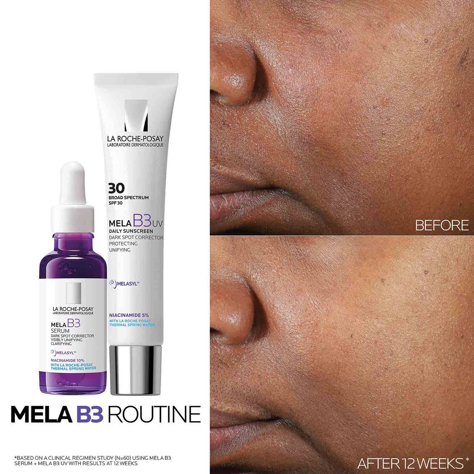 mela-b3-dark-spot-serum-with-melasyltm-niacinamide-m7 Mela-B3-routine_1500X1500.jpg